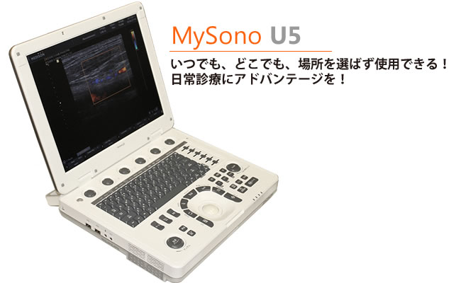 MySono U5